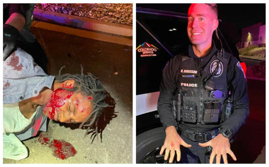 Cop Smiles after Violently Beating Homeless Army Vet