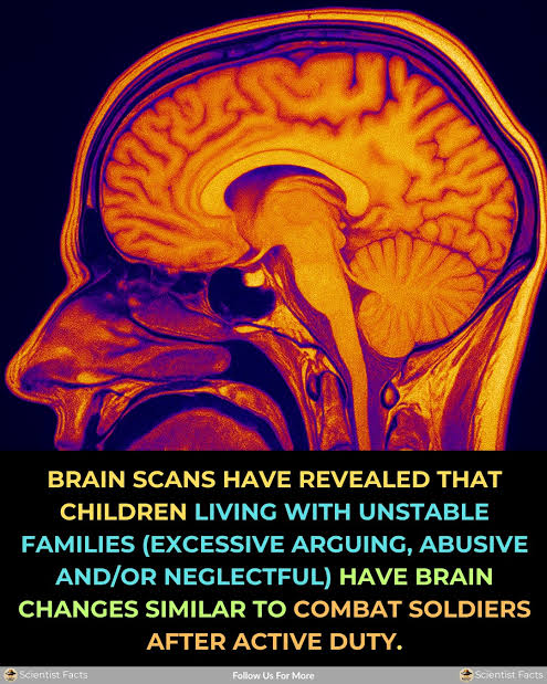 Brain scan illustration: children living with unstable families show brain changes similar to combat soldiers