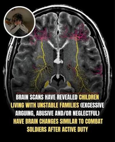 Children exposed to family violence show heightened amygdala and anterior insula activity